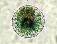 Ichthyophthirius-multifiliis unter dem Mikroskop