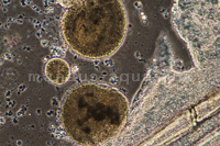 Hautabstrich des Ichthyophthirius-multifiliis unter dem Mikroskop
